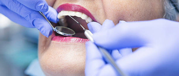 Best Emergency Broken Tooth Repair in East York, PA